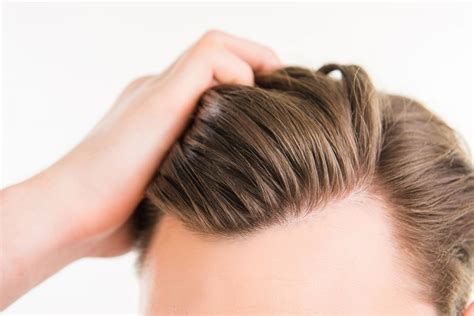 The Stages Of Hair Loss How Much Hair Loss Is Normal Regenrx Hair