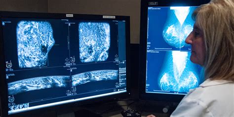 Beaumont 1st In Nation To Install Invenia Automated Breast Ultrasound 2