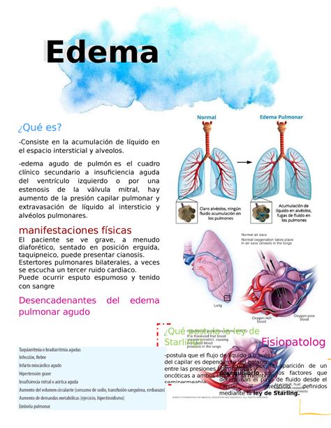 Acute Pulmonary Edema Edema Edema Qu Es Consiste En La