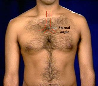 Bronchial tree