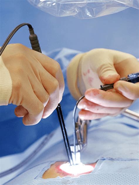 Gallbladder Removal Surgery Information World Laparoscopy Hospital