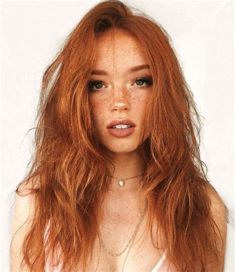 Ginger And Freckles Skin That Is Valuable Skin Transplant Worn By People Ginger Hair