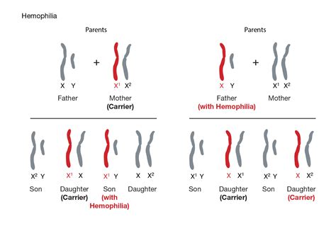different types of hemophilia diagram