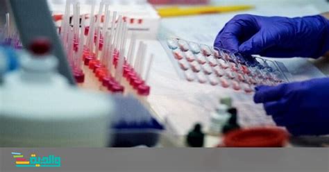 تفقد الدكتور ناصر الجيزاوي القائم بأعمال رئيس جامعة بنها أعمال تطعيم أعضاء هيئة التدريس والجهاز الإداري المشاركين في اعمال امتحانات الفصل الدراسي الثاني بالتنسيق مع وزارة الصحة والسكان وذلك بناء على ما قررته لجنة. عام على الكورونا: استنتاجات أولية | والدية | عرب 48