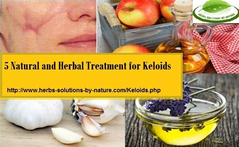 5 Natural And Herbal Treatment For Keloids Herbs Solutions By Nature