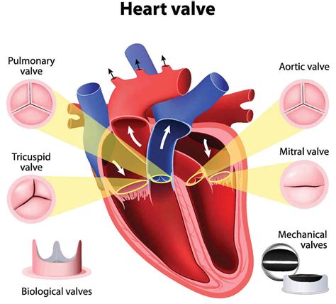 Aortic Valve Disease Causes Symptoms Exercises And Treatment