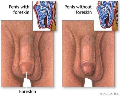 The New York Times Health Image Circumcised Vs Uncircumcised