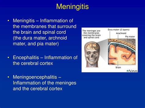 Ppt Meningitis Powerpoint Presentation Free Download Id4591726