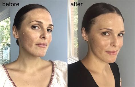 30 Days Of The True Botanicals Anti Aging Skin Regimen Before And After