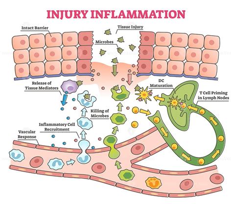 Injury Inflammation As Body Response Process In Educational Outline