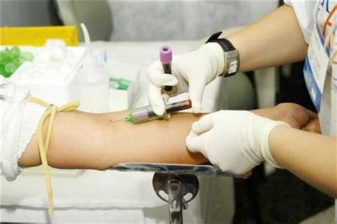 Exames de sangue são exames laboratoriais realizados no sangue para adquirir informações sobre doenças e funções dos órgãos. Confira sete dicas para fazer exame de sangue