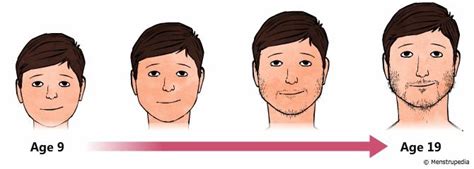 Illustration Of Appearance Of Facial Hair During Puberty In Boys From