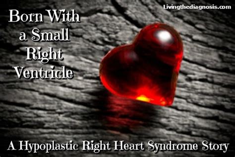 Born With A Small Right Ventricle A Hypoplastic Right Heart Syndrome