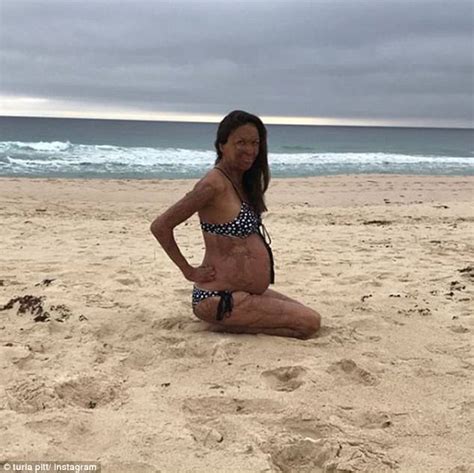 Turia Pitt Shows Off Her Baby Bump On Instagram Daily Mail Online