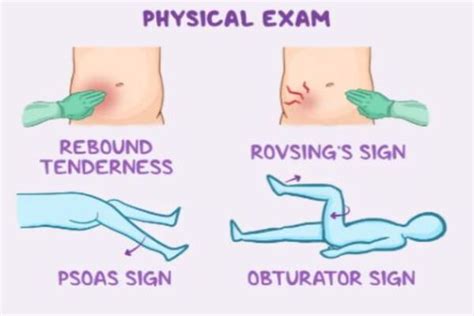 Psoas Sign And Obturator Sign