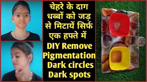 It naturally sustains the skin. DIY Remove Pigmentation, Dark circles, Dark spots, Pimple ...