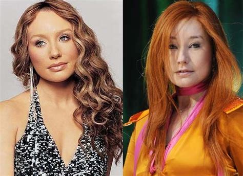 Tori Amos Plastic Surgery Photo Before And After Plastic Surgery Photos Celebrity Plastic