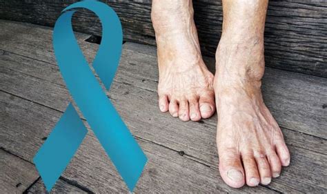 What Does Cancer Of The Foot Look Like Skin Cancer In The Feet