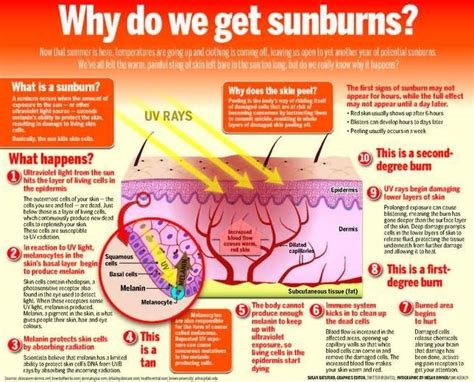 Why Do We Get Sunburns Apologia Anatomy Human Body Unit Natural