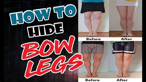 How To Hide Bow Legs Best Result For How To Hide Bow Legs Youtube
