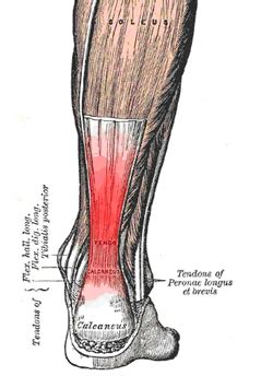 Alibaba.com offers 242 massage achilles tendonitis products. The Ultimate Runner's Guide to Achilles Tendinitis ...