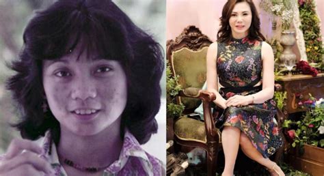 Before And After Plastic Surgery Filipino Celebrities