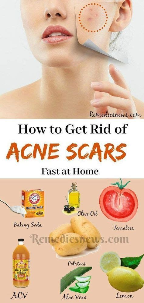 Scar Remedies