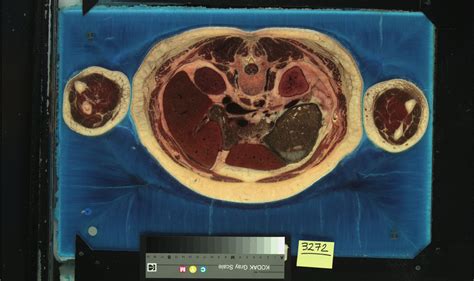 The Visible Human Project Full Color Anatomical Images