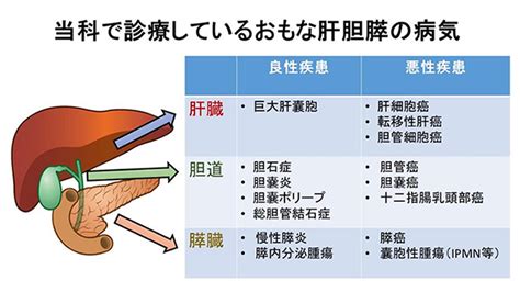 肝胆膵グループ｜診療案内｜産業医科大学 医学部 第1外科学教室 消化器・内分泌外科