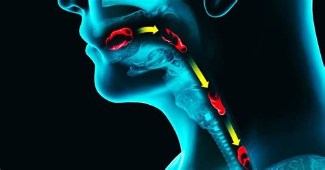 Cary Gastroenterology Associates Understanding The Symptoms And