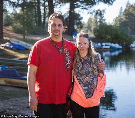 California Woman With Craniofacial Disorder Embraces Look Daily Mail