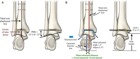 Normal Foot And Ankle Radiographic Angles Measurements And Reference