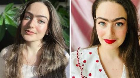 donna smette di radersi la peluria che ha in volto e un anno dopo mostra le sue foto sui social
