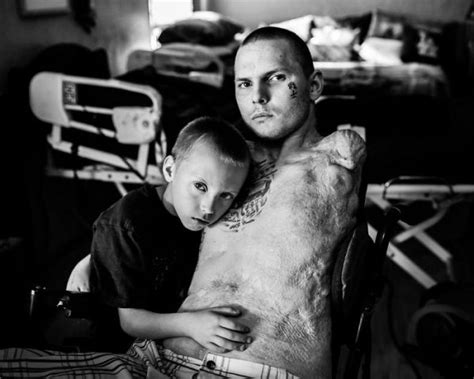 10 Graphic Photos Of Heroic Veterans After War In Iraq And Afghanistan