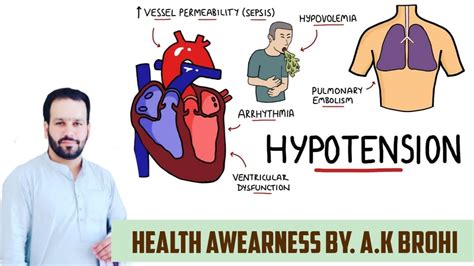 Hypotension Types Etology Symptoms And How To Prevent From