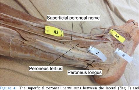 Figure 4 From Clinical Anatomy The Superficial Peroneal Nerve A Review