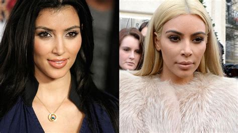 Kim Kardashian Before And After Inside Her Secret Surgery Transformation