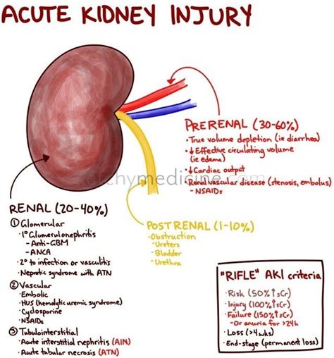 Acute Kidney Injury Can Be Caused By Problems Directly In The Kidney