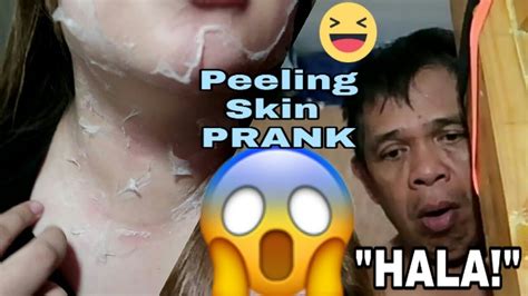 Peeling Skin Prank First Time Mag Prank Leahdiaries Youtube