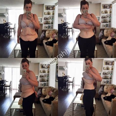 A Blogger Shows The Reality Of A Dramatic Weight Loss