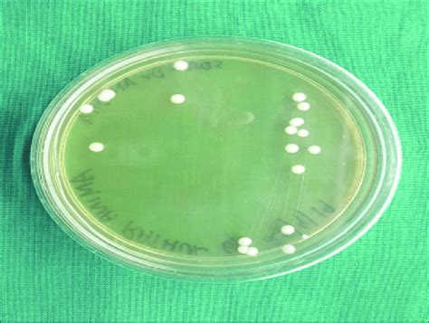 Growth Of Candida Colonies On Sabouraud Dextrose Agar Plate Download