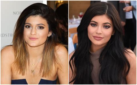 Kylie Jenner After And Before Pictures Did She Do Surgery Demotix