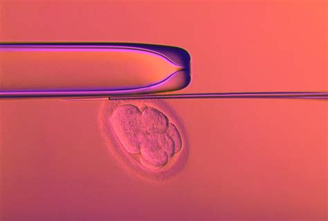 Ivf Embryo Testing Photograph By Pascal Goetgheluckscience Photo