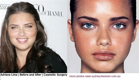 Adriana Lima Before After Cosmetic Surgery Cosmetic Surgery Adriana