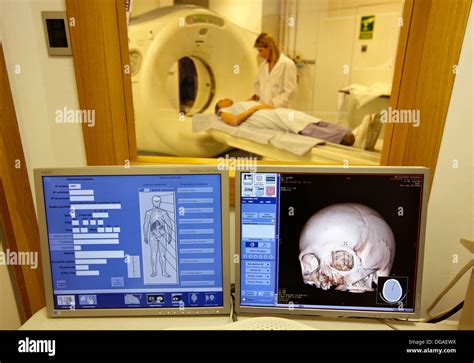 Schädel Axial Computertomographie Ct Radiologie Medizinische