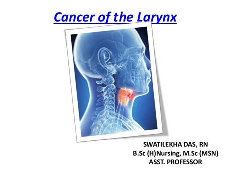 Cancer Of Larynx Easy Ppt For Nurses