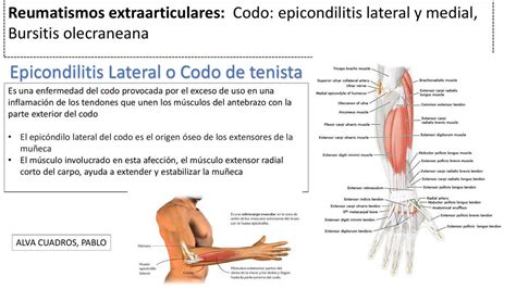 Epicondilitis Lateral Medial Pablo Jesús Alva Cuadros Udocz