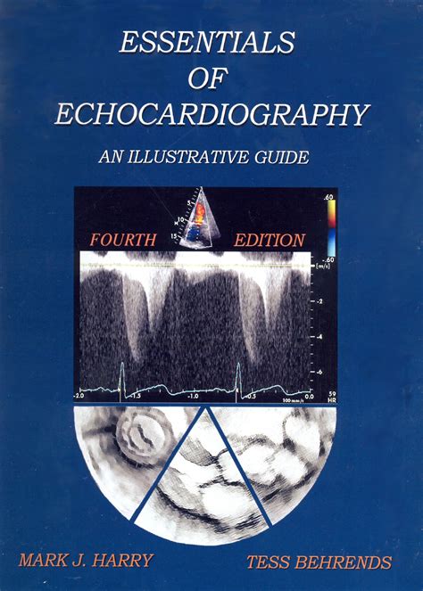 Essentials Of Echocardiography An Illustrative Guide — Cardiotext