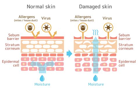 How To Repair A Damaged Skin Barrier Skin Library Uk