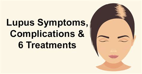 Lupus Symptoms Complications And 6 Treatments David Avocado Wolfe